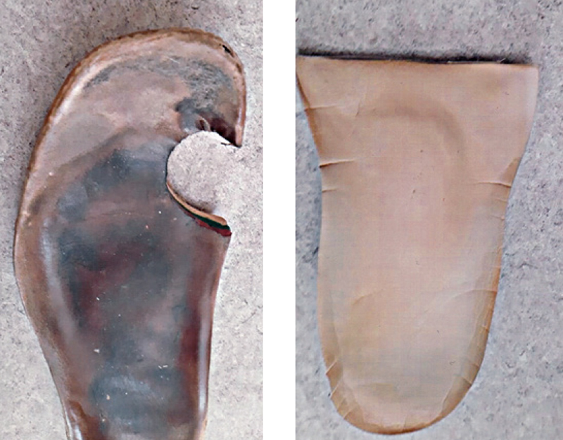 3  Detailbilder der selbst improvisierten Fußbettungen des Betroffenen im Fallbeispiel. Fotos: Renate Wolansky