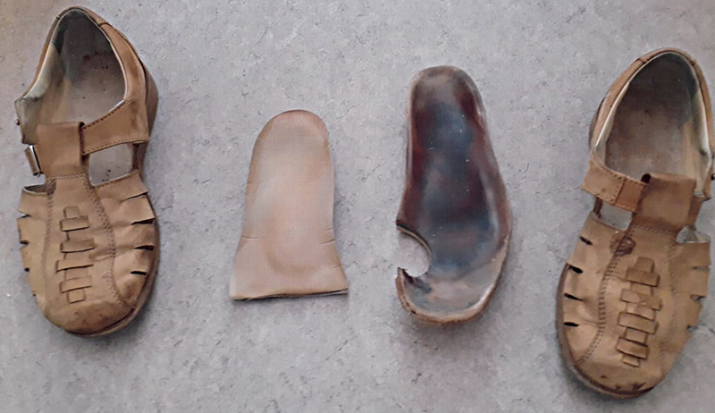 2  Alte unpassende orthopädische Sandalen und die vom Betroffenen aus- und abgeschnittenen diabetesadaptierten Fußbettungen. Foto: Renate Wolansky