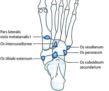 Grafik: Akzessorische Knochen am Fuß (Ossa accessoria pedis)