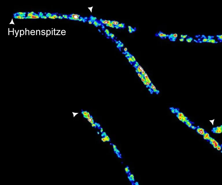 Der Verlust des RNA-bindenden Proteins stört den Membrantransport. Die angefärbten Vakuolen sammeln sich nicht mehr an der Hyphenspitze, sondern verteilen sich in der gesamten Hyphe. Weiße Pfeilspitzen zeigen die Hyphenspitze an.